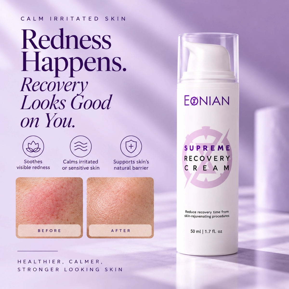 Supreme Recovery is a soothing moisturizer for sensitive, redness-prone and compromised skin, formulated to deeply hydrate while supporting the skin barrier and a balanced skin microbiome.